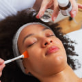 All You Need to Know About Chemical Peels