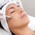 All You Need to Know About Microdermabrasion