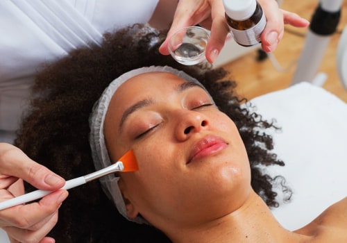 All You Need to Know About Chemical Peels